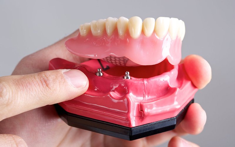 Full & Partial Dentures
